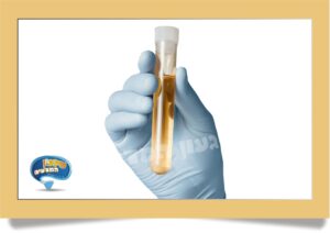 מבחנה פלסטיק